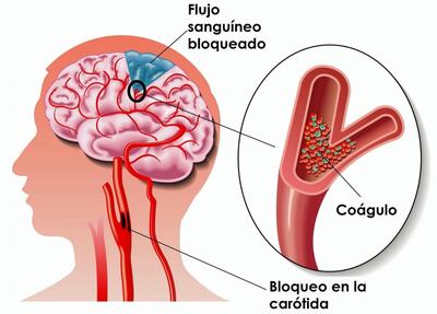 /pf/resources/images/abc-placeholder.png?d=2425