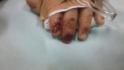 /pf/resources/images/abc-placeholder.png?d=2394