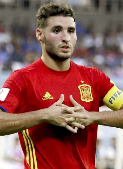 /pf/resources/images/abc-placeholder.png?d=2393