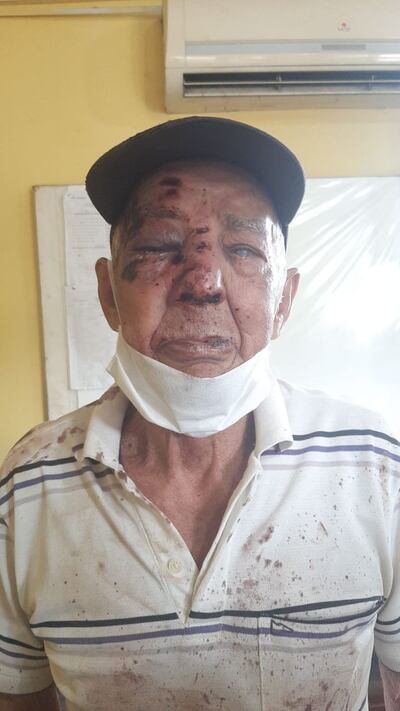 Don Eladio Olmedo Centurión (73) brutalmente agredido por su sobrino por negarse a mirar el celurar
