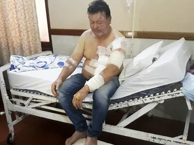 Fermín Iriarte se recupera en una clínica privada de Caaguazú de las quemaduras que sufrió al salvar a sus dos hijas.