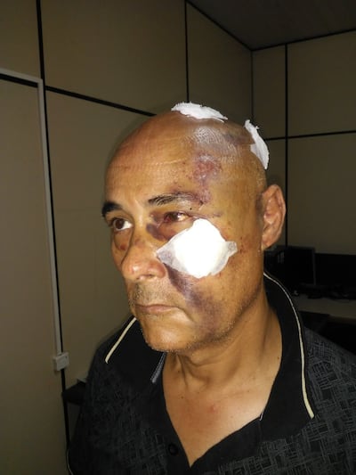 El hombre fue brutalmente golpeado por los asaltantes.