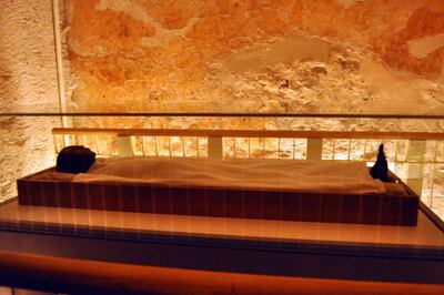 /pf/resources/images/abc-placeholder.png?d=2393