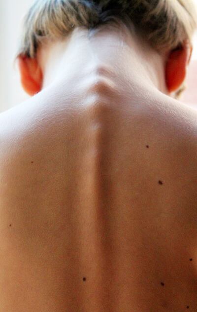 /pf/resources/images/abc-placeholder.png?d=2395