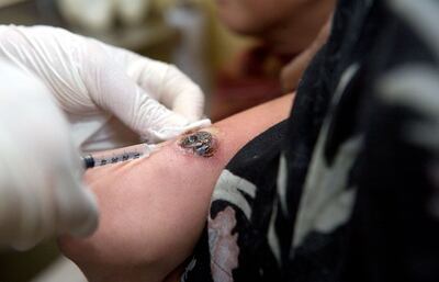 /pf/resources/images/abc-placeholder.png?d=2395