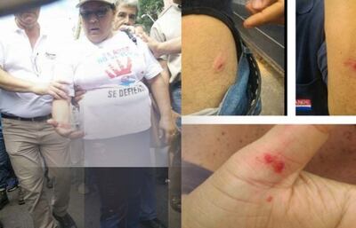 /pf/resources/images/abc-placeholder.png?d=2394