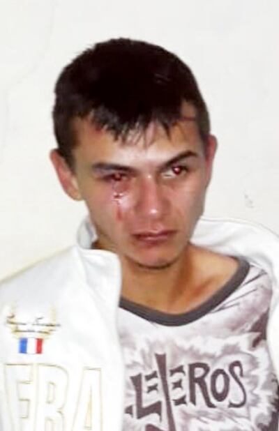 /pf/resources/images/abc-placeholder.png?d=2394