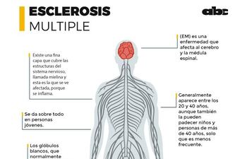 esclerosis-161235000000-1719653.jpg