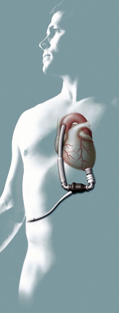 /pf/resources/images/abc-placeholder.png?d=2421