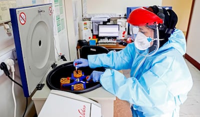 El número de personas infectadas de covid-19 en el mundo llegó a 101.988, de las cuales 3.492 fallecieron, en 95 países y territorios. En Irán ya murieron por el mal 145 ciudadanos. Autoridades sanitarias trabajan contra reloj en laboratorios (foto).