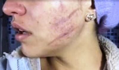 /pf/resources/images/abc-placeholder.png?d=2393