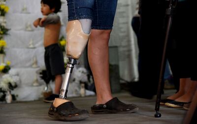 /pf/resources/images/abc-placeholder.png?d=2394