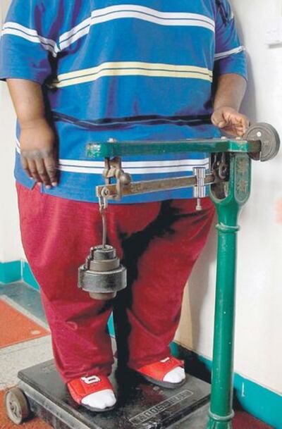 La forma del cuerpo no debe ser una deshonra ni hay que sentirse mal por ello, sin embargo, en el caso de tener obesidad o sobrepeso, es importante tomar medidas temprano para evitar enfermedades graves.