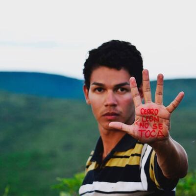 /pf/resources/images/abc-placeholder.png?d=2428