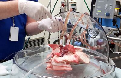 /pf/resources/images/abc-placeholder.png?d=2395