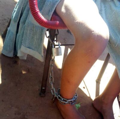 /pf/resources/images/abc-placeholder.png?d=2394