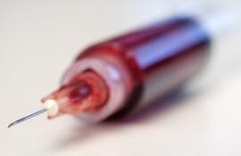 el-analisis-de-sangre-te-dara-una-rapida-idea-de-cual-es-tu-estado-general--90748000000-1758702.jpeg
