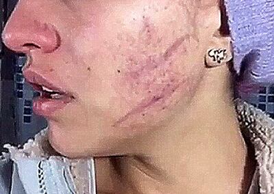 /pf/resources/images/abc-placeholder.png?d=2393