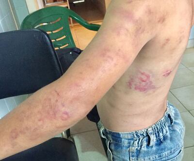 /pf/resources/images/abc-placeholder.png?d=2395