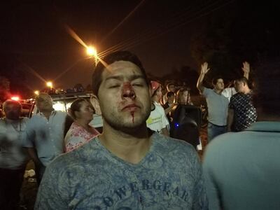 /pf/resources/images/abc-placeholder.png?d=2394