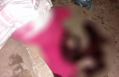 /pf/resources/images/abc-placeholder.png?d=2394