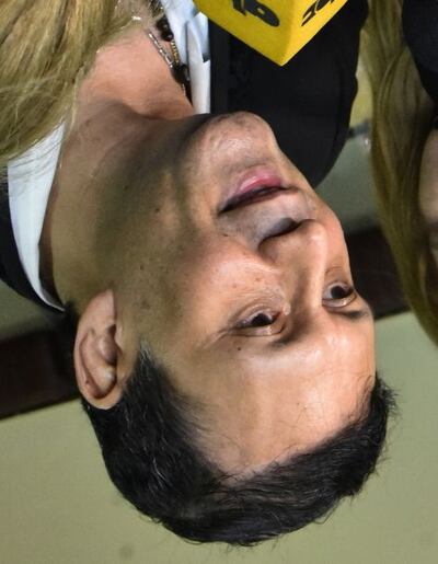 /pf/resources/images/abc-placeholder.png?d=2393