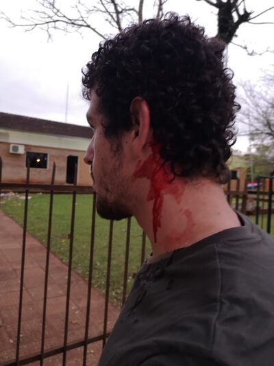 Heridos en trifulca en Jesús de Tavarangüe