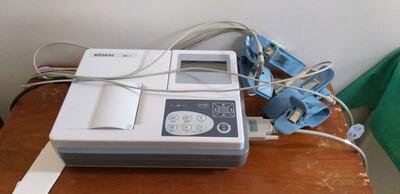 Según fuentes, Julio Núñez, ordenó que el registro de entrega de la máquina figure con fecha de febrero o de marzo, pero los funcionarios de turno de la clínica municipal se negaron e inscribieron la fecha correcta.