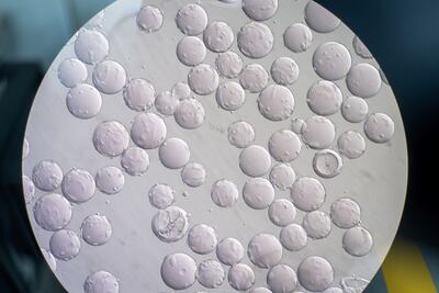 Células de riñón de un mono son vistas a través de un microscopio, mientras son testeadas con una vacuna contra el coronavirus.