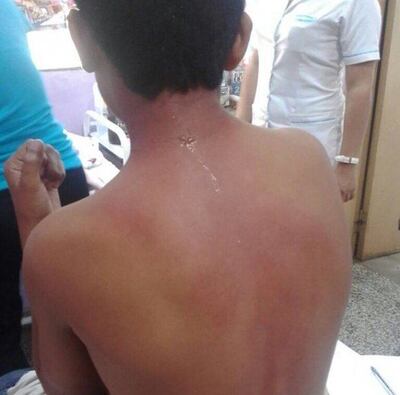 /pf/resources/images/abc-placeholder.png?d=2393