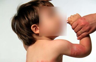 /pf/resources/images/abc-placeholder.png?d=2402