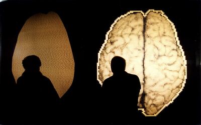 /pf/resources/images/abc-placeholder.png?d=2421