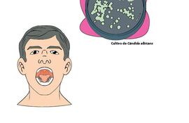 enfermedades-infecciosas-220455000000-568443.jpg