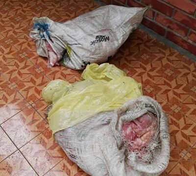 /pf/resources/images/abc-placeholder.png?d=2429