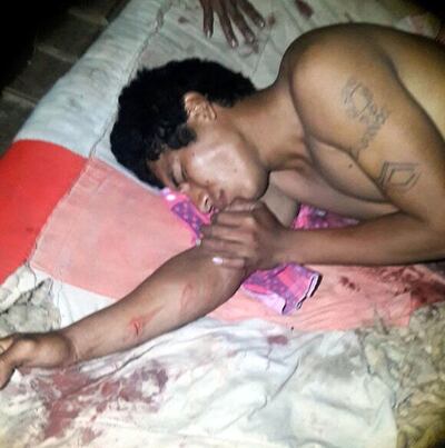 /pf/resources/images/abc-placeholder.png?d=2395