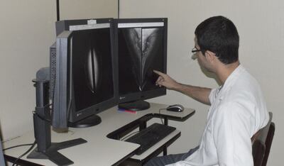 /pf/resources/images/abc-placeholder.png?d=2428