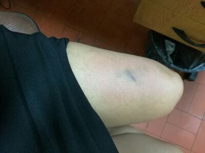 /pf/resources/images/abc-placeholder.png?d=2421