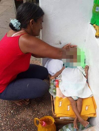 /pf/resources/images/abc-placeholder.png?d=2395