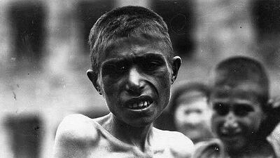 /pf/resources/images/abc-placeholder.png?d=2421