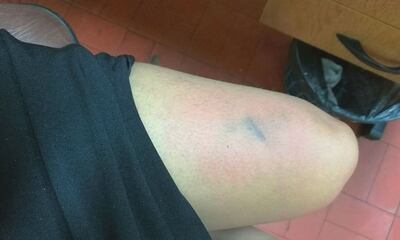 /pf/resources/images/abc-placeholder.png?d=2420