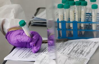 "Solidarity", el mayor ensayo del mundo para encontrar el mejor tratamiento contra el coronavirus.