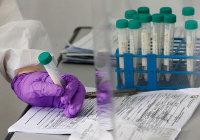 "Solidarity", el mayor ensayo del mundo para encontrar el mejor tratamiento contra el coronavirus.