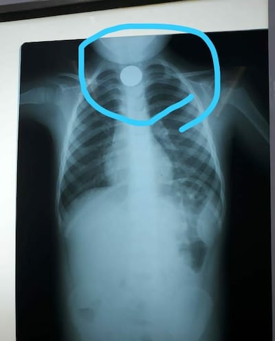 /pf/resources/images/abc-placeholder.png?d=2394