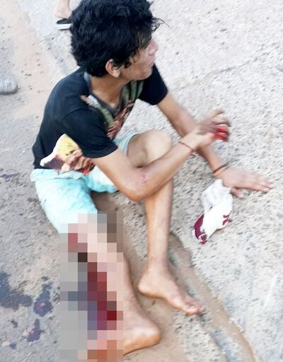 /pf/resources/images/abc-placeholder.png?d=2395