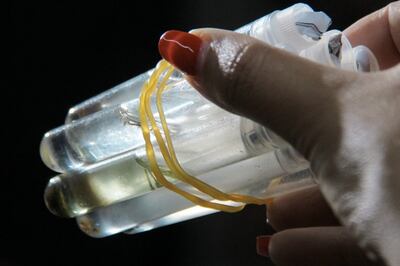 La mayor cantidad de casos de dengue se concentra en Capital y el departamento Central.