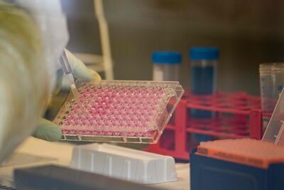 Análisis de muestras en busca de coronavirus en el laboratorio del hospital universitario Petz Aladar en Gyor (Hungría).
