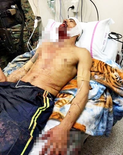 /pf/resources/images/abc-placeholder.png?d=2393