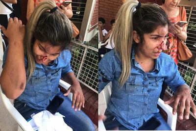 /pf/resources/images/abc-placeholder.png?d=2394