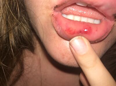 /pf/resources/images/abc-placeholder.png?d=2429