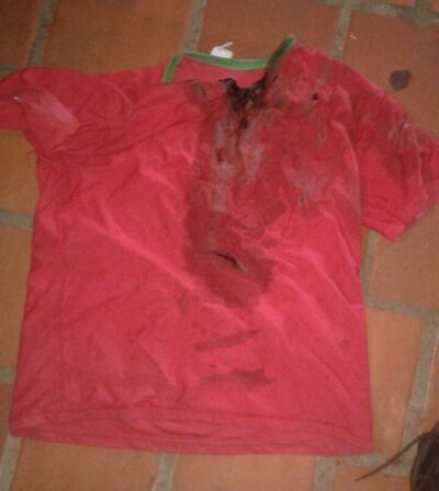 /pf/resources/images/abc-placeholder.png?d=2394